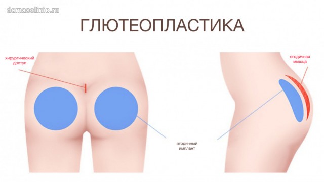 Женщины с большой попой не только умнее, но и…