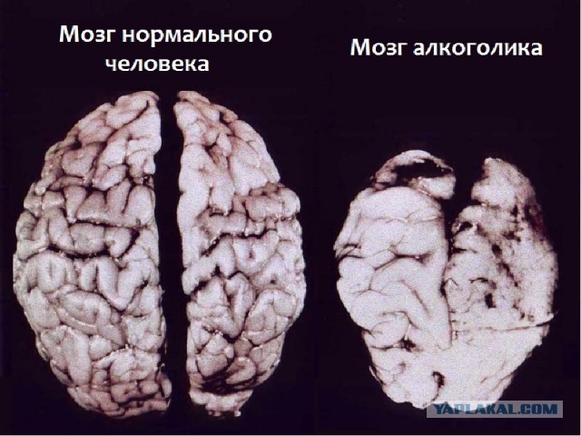 Как избавиться от тремора