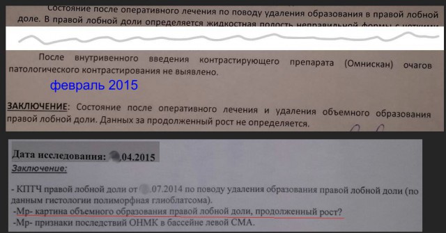 Неласково о Фриске