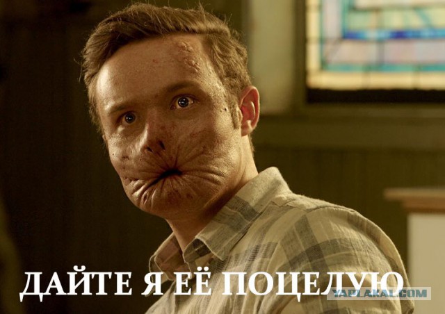 У знаменитой охотницы за олигархами продолжают расти губы