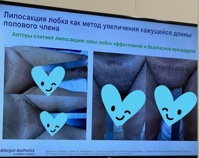 Аморальная деградация