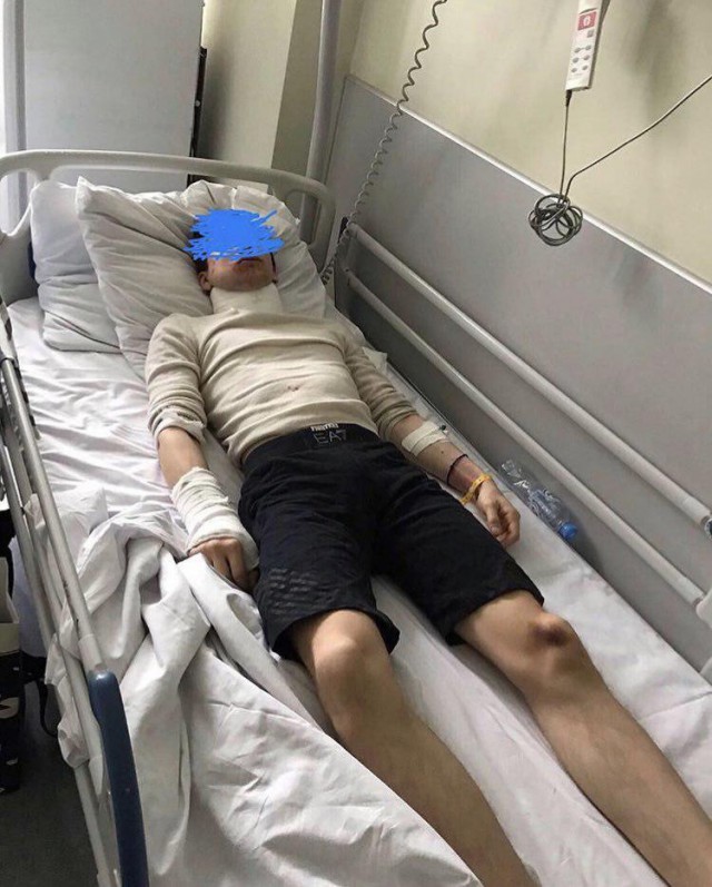 В Москве жестоко избили парня, который не поделился своей девушкой
