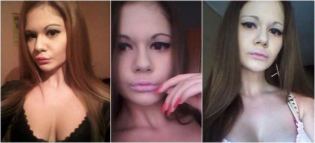 Немного жести на понедельник: болгарская студентка увеличила губы в три раза и не собирается останавливаться на достигнутом