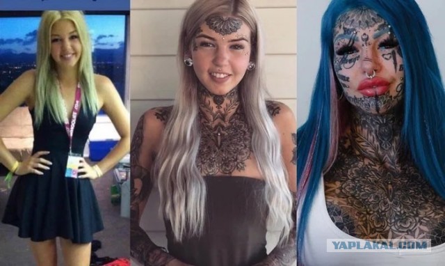 Три стадии психического заболевания