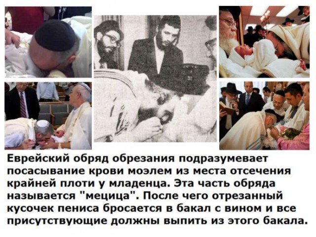 Трехлетний мальчик умер после домашнего обрезания в Красноярске