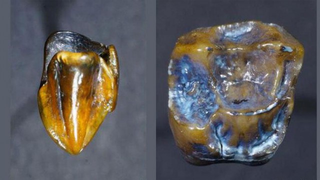 Найденные в Германии зубы, которым 9,7млн лет, могут переписать историю человечества