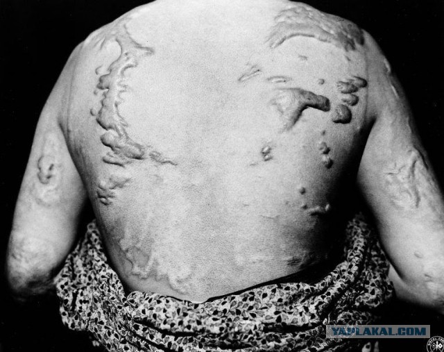 Хиросима и Нагасаки: Фотографии с места событий