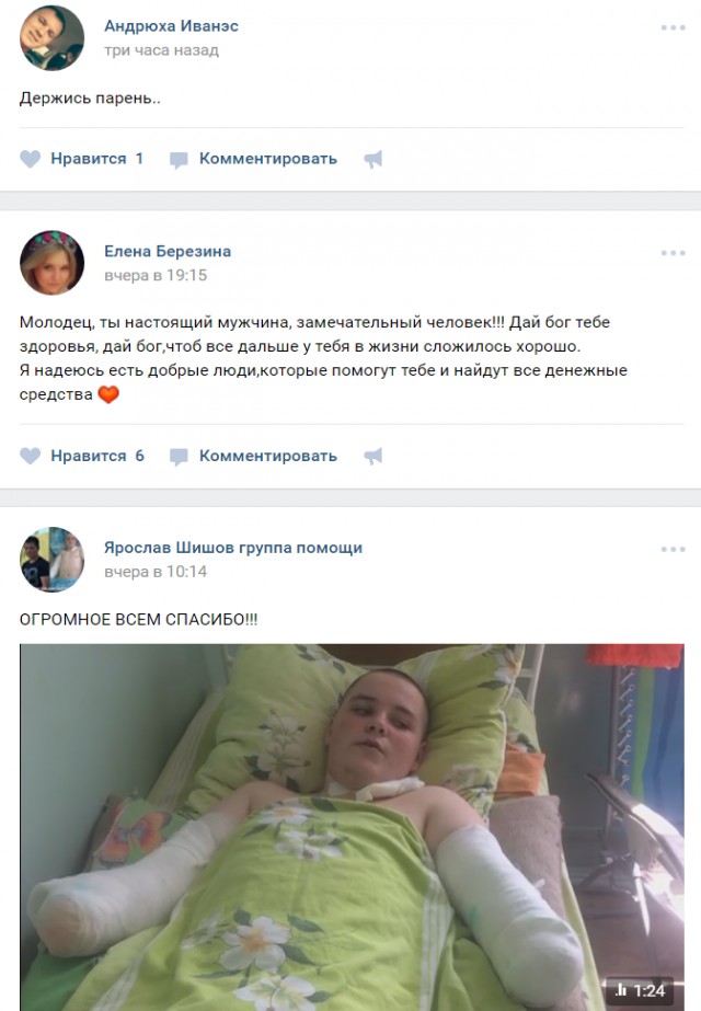 16 летний подросток из Барнаула рассказал, как лишился рук, спасая котенка
