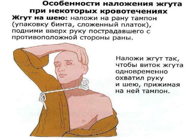 Записки деревенского ветеринара ч.4
