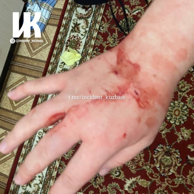 Подписчица попросила разместить  пост, как мужчина избил женщину  металическим ошейником за замечание к его собаке