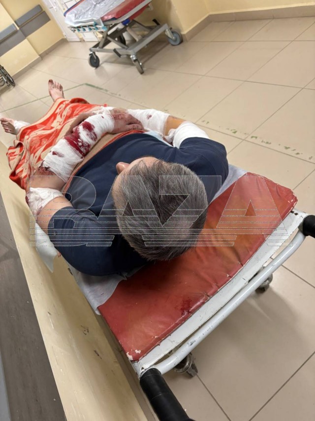 В Перми два стаффорда набросились на случайного прохожего
