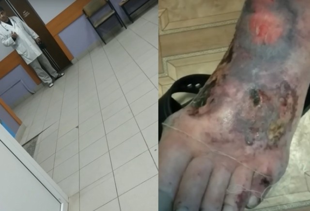 В Омске уволили врачей, отказавшихся делать перевязку пациенту