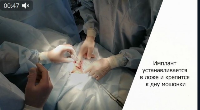 Пандемия съехавших крыш - разновидности болезни. Россия и мир. Часть 42.