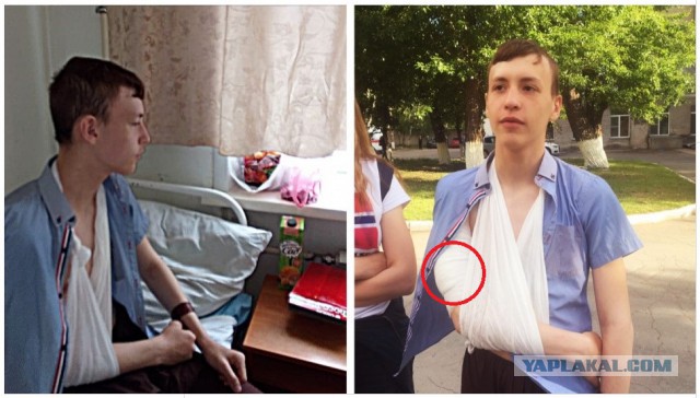 «Выстрелил в спину ребёнку»: школьнику в костюме разбойника прострелили плечо из-за наряда