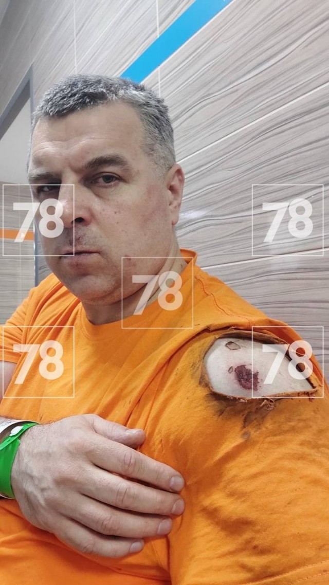 Пьяный мужчина стрелял из сигнального пистолета в охранника ТЦ на Савушкина. Пострадавшим оказался актёр