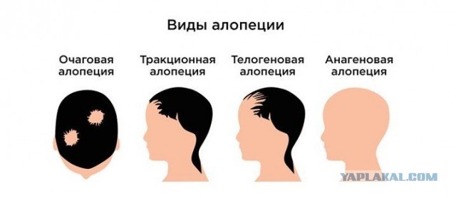 Пацаны, нам выкатили список новых требований...