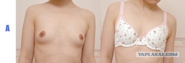 Так какой размер?1-й, 2-й или 6-й?, О горестях дам ( о сиськах)