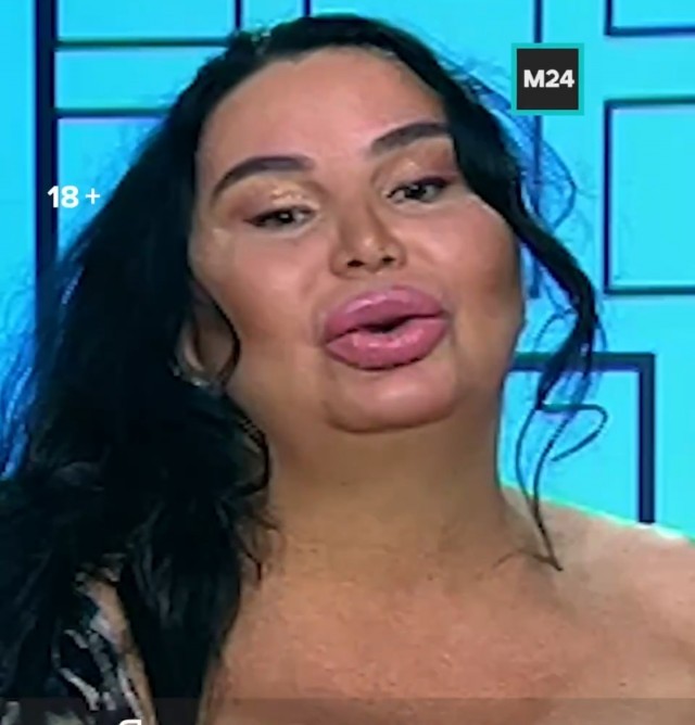 «Мне с этим некомфортно», — призналась обладательница самого большого бюста в России Ирен Феррари.