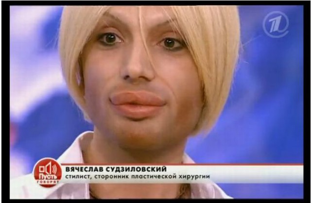 Трудовые мозоли