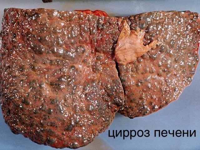 Ну что, прилетели ваши немцы?