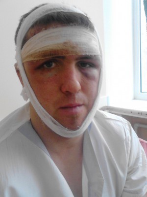 Дагестанцы до полусмерти избили парня.