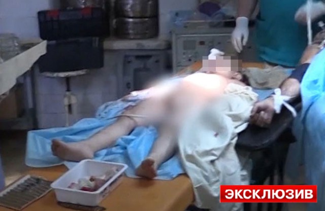 5-летний ребенок, раненный при обстреле Славянска