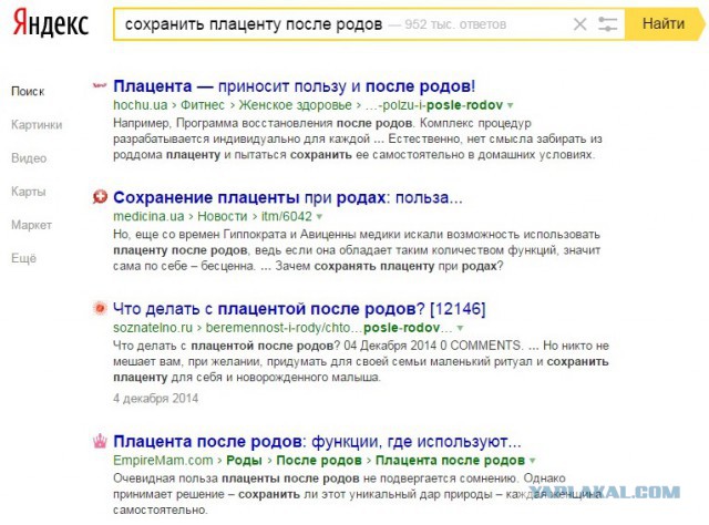А где вы храните плаценту?
