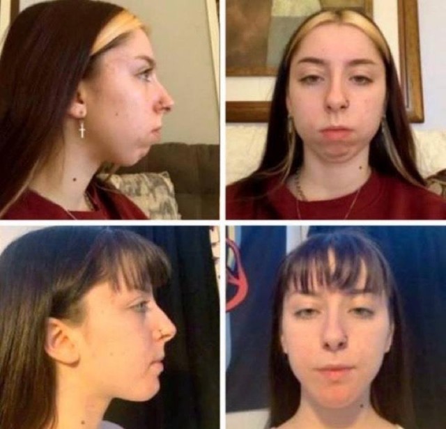 Те случаи, когда пластическая хирургия во благо