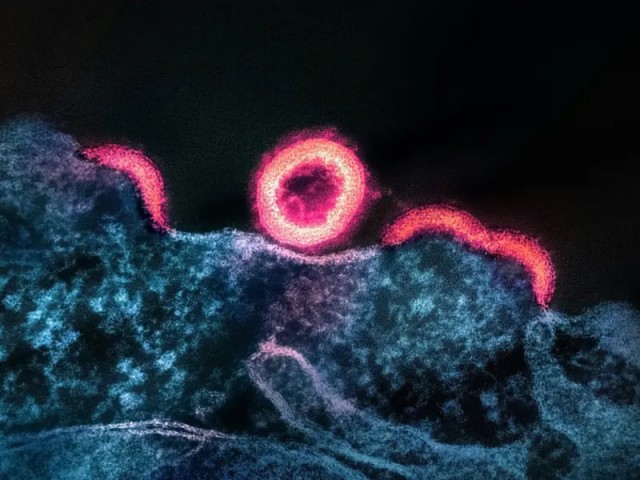 Соскучились по пандемиям? На Аляске выкопали новый вирус