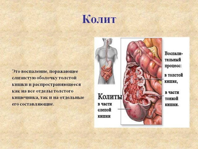 Телеведущий сравнил Серену Уильямс с обезьяной и поплатился