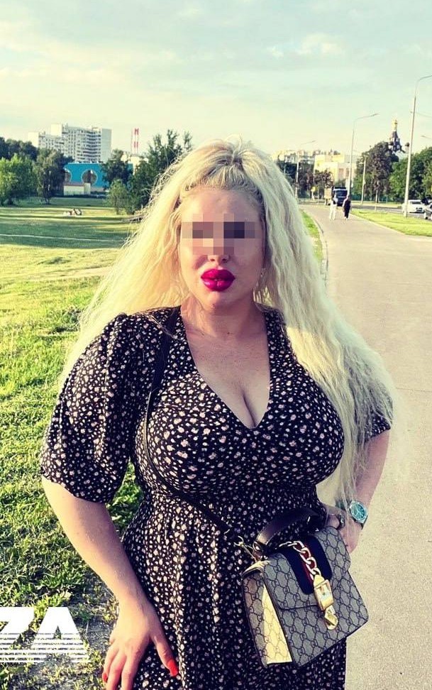 Девушку из Москвы госпитализировали с тяжелейшими травмами головы якобы из-за упавшего зеркала.