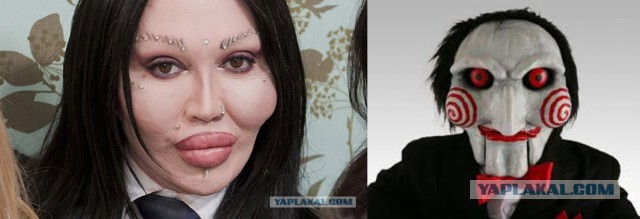 8 наших и зарубежных звезд, которые изуродовали себя пластикой