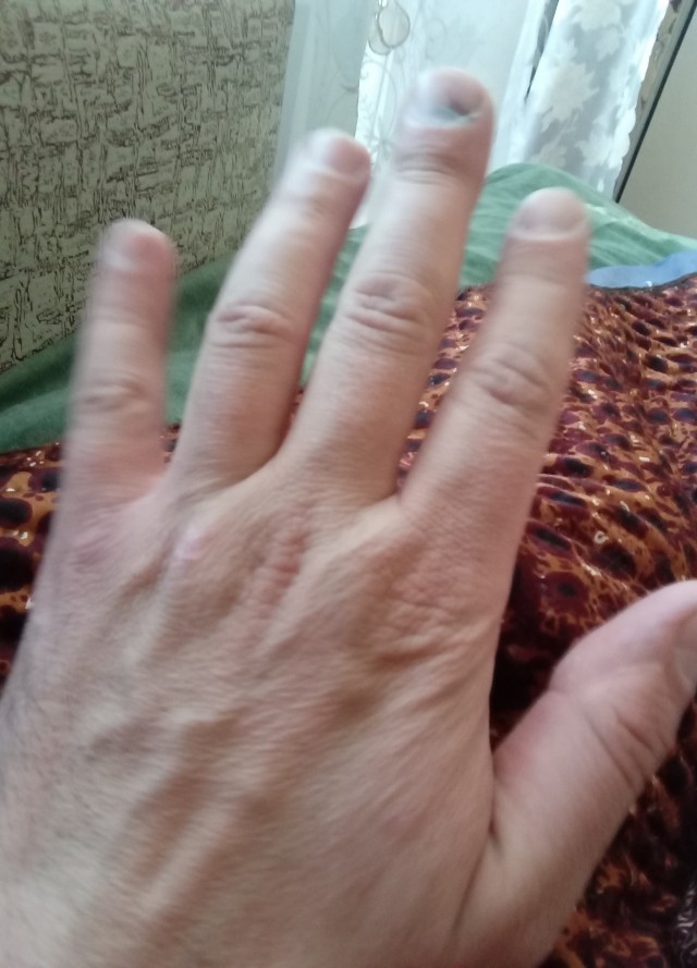 Руки обычного грузчика