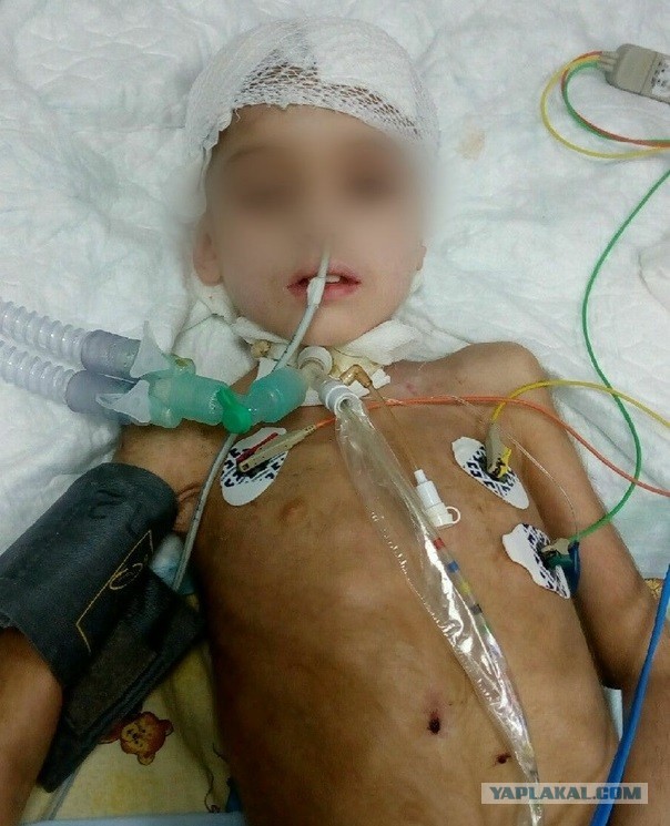 Мама семилетнего мальчика, которому прострелили голову в Нижнем Тагиле