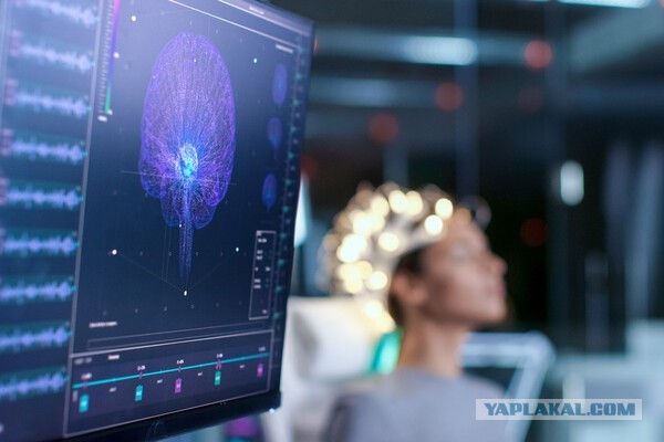 Frontiers: немецкий ученый предположил, что сознание возникает не в мозге