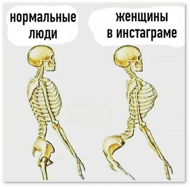 Что у них с позвоночником?