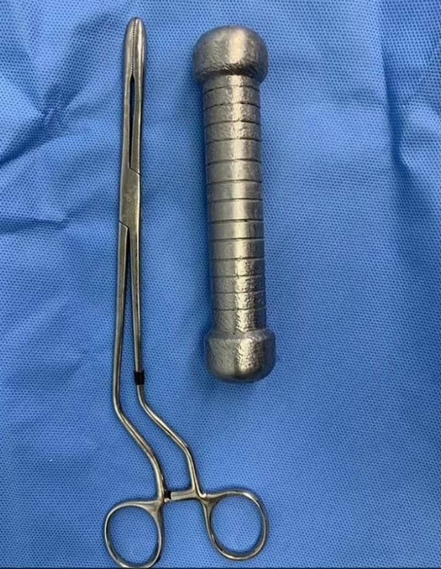 Мужчина сутки ходил с кабачком в заднем проходе