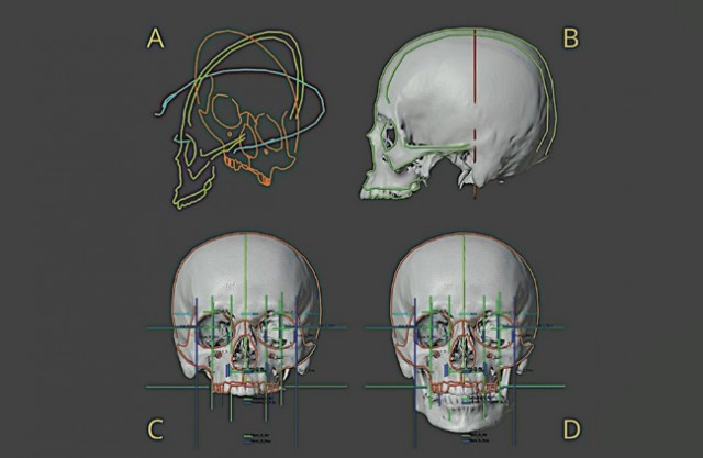 Ученые восстановили внешность Моцарта по его черепу