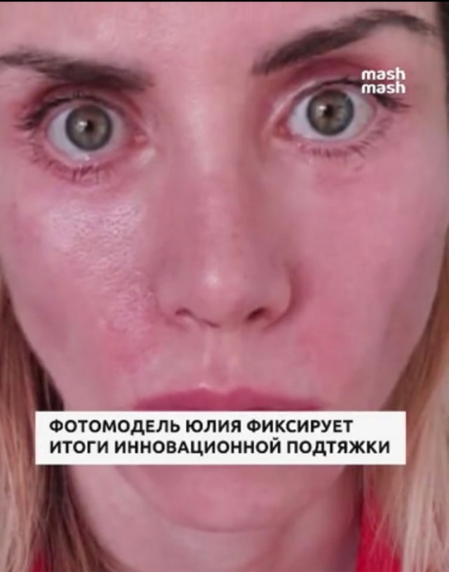 Подтянула личико