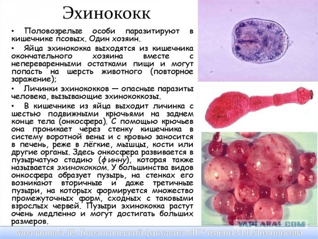 В Челябинске 12-летний мальчик заразился эхинококкозом головного мозга