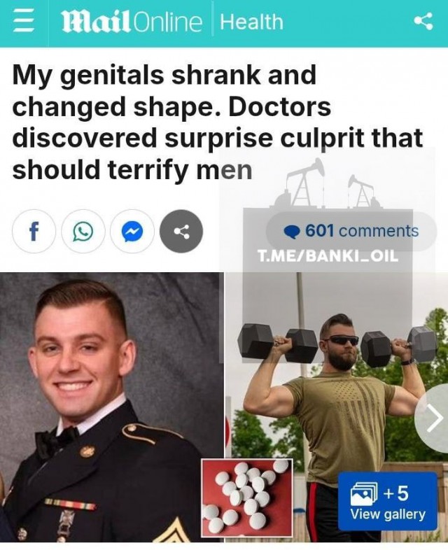 Лысому не повезло , попал в 5 %