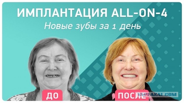 19-летний москвич умер после лечения 11 зубов за один прием