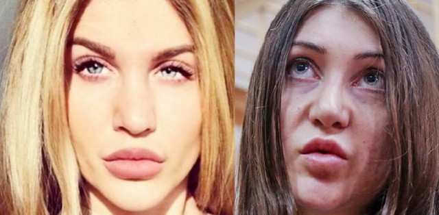 Жена брянского депутата Коломейцева пригрозила переехать обидчиков дочери