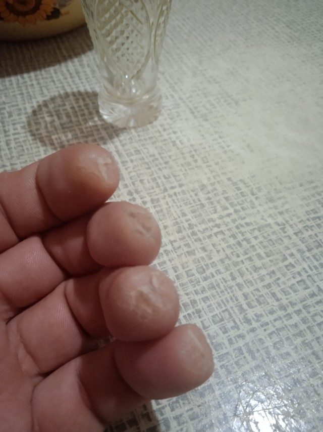 Пальцы гитариста