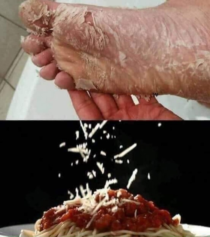 Бредзона (кулинария)
