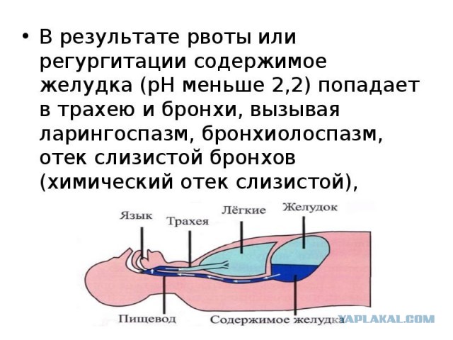 Девушка, оказавшаяся в больнице после 20 шотов в баре «Руки Вверх!», сейчас чувствует себя нормально