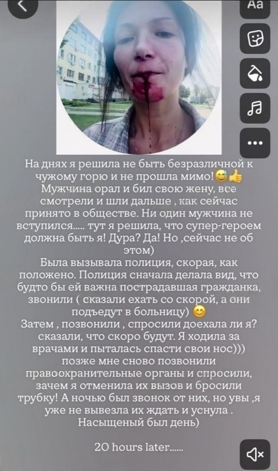 Воронежский неадекват избил жену и ударил девушку скейтбордом по лицу