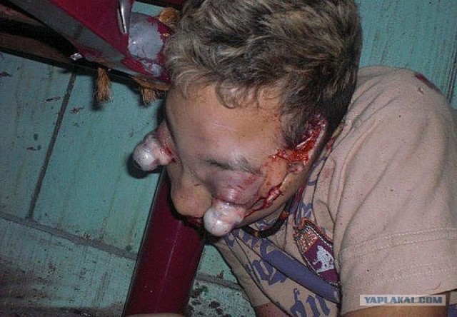 Правильный способ вырвать себе зуб