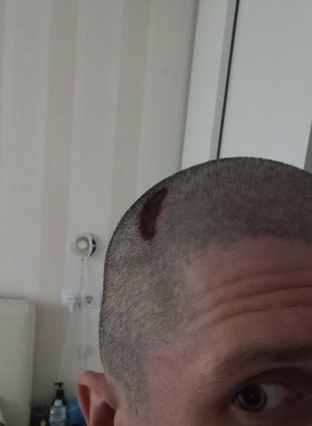 Эх, блин, да я и не жалуюсь, поделиться не с кем