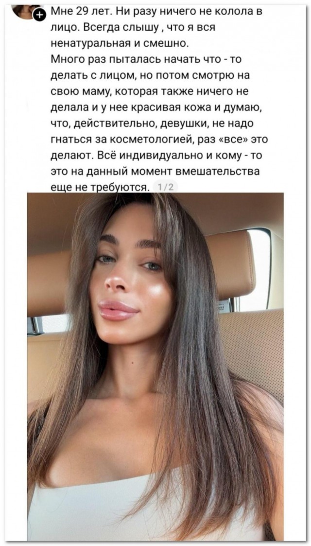 «Ни разу ничего не колола в лицо»